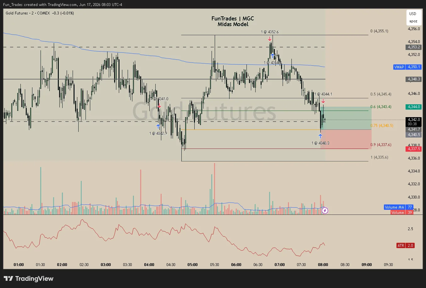 A real MIDAS trade on micro gold (MGC), 2-minute chart — price sweeps a low to the left of the VAL before building the leg that sets up the 0.75 entry.